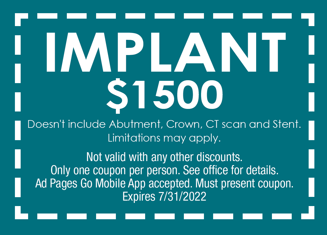 $1500 Implant, Doesn't include abutment, crown, ct scan and stent. Limitations may apply.